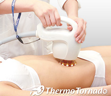 スパアクセントトルネード