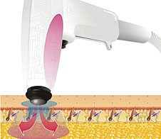 脂肪やセルライトを溶かす